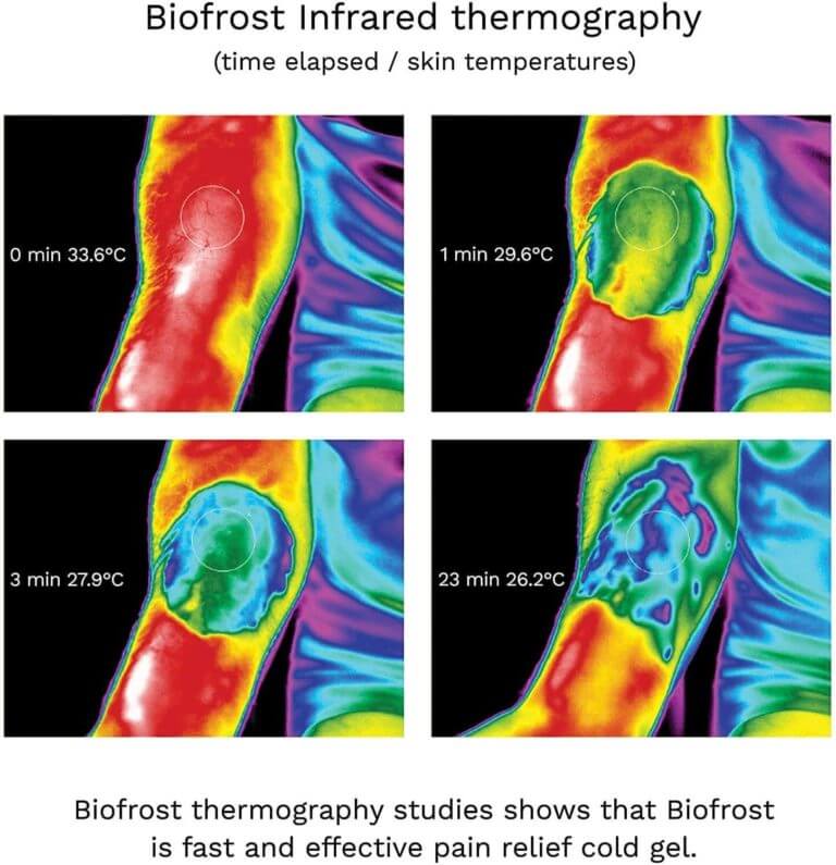 biofrost effective pain relief infrared thermography pictures